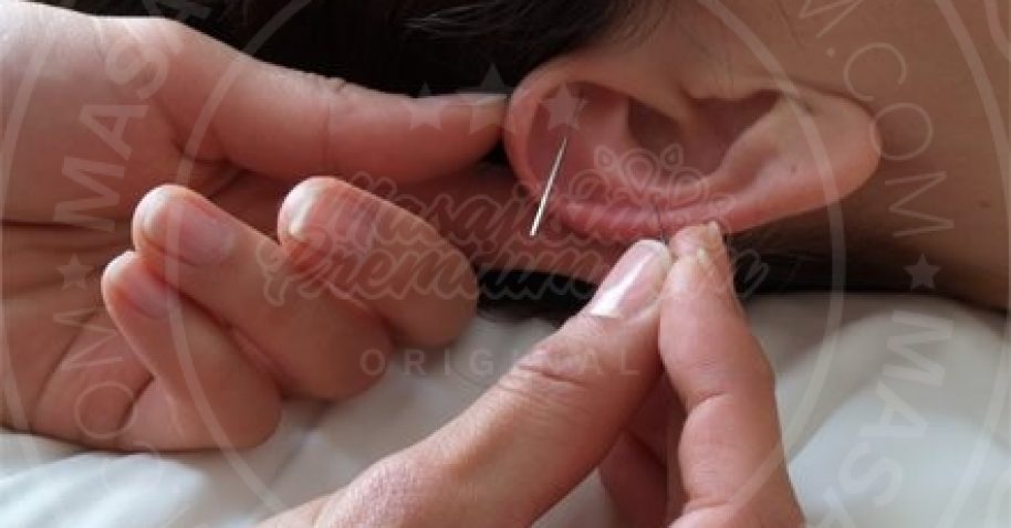 aplicacion-auriculoterapia